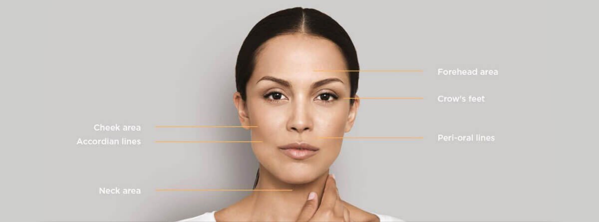 Restylane Skinboosters for a Glowing Look!